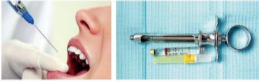 胰島素，牙科麻醉6.png